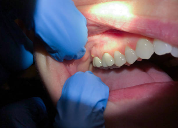 Best Knocked-Out Tooth Emergency  in Superior, AZ